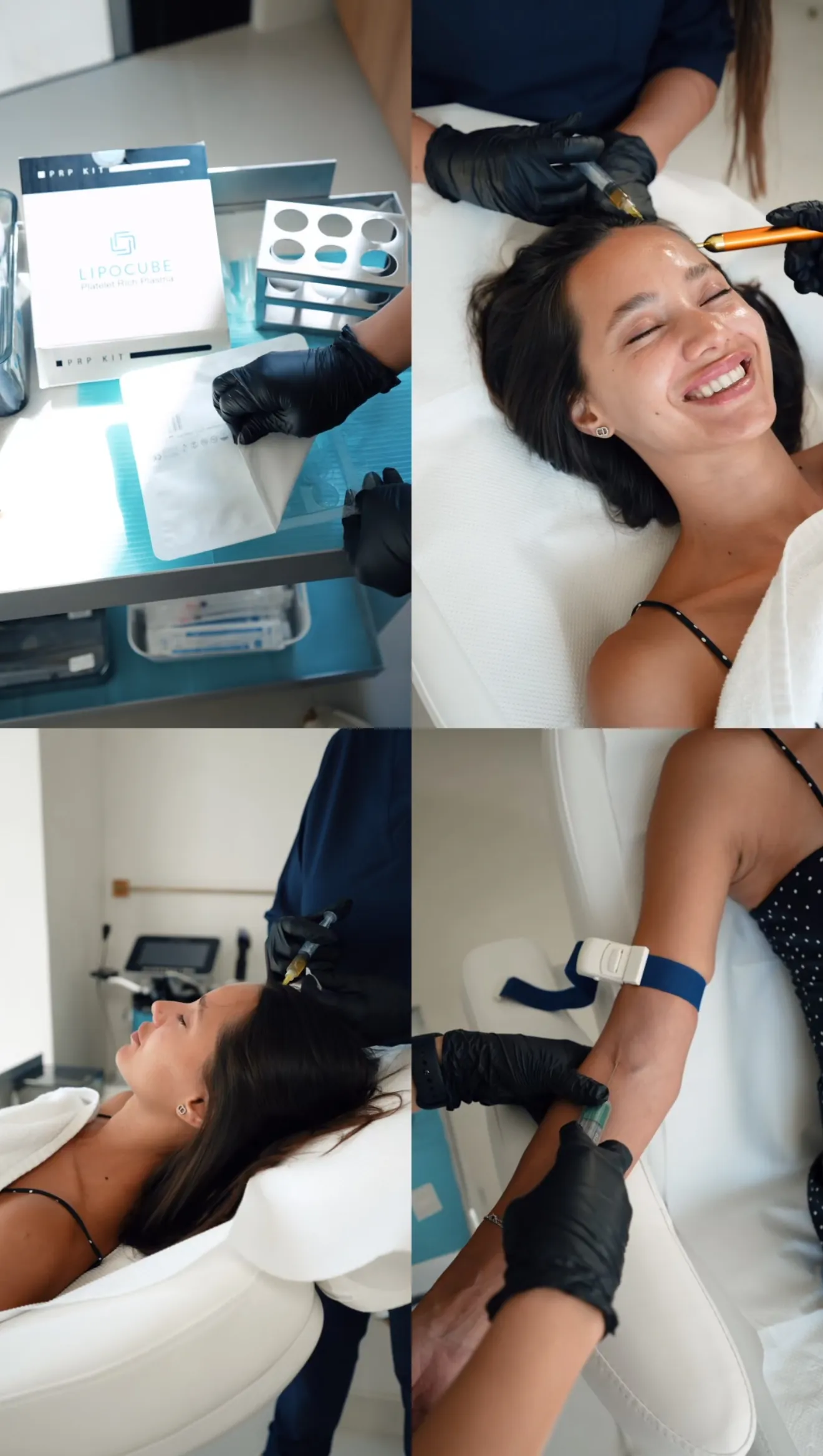 PRP treatment, four-frame collage